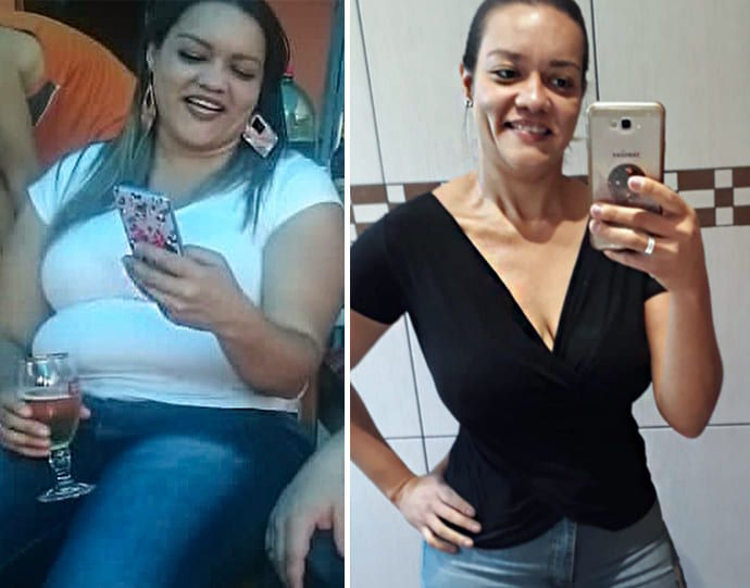 Before/after losing weight